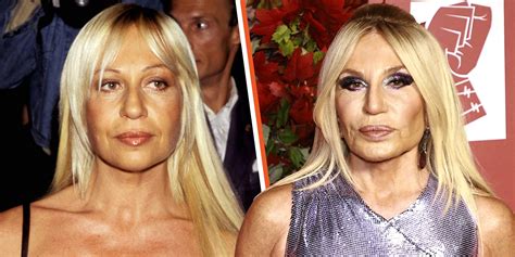 quando è nata donatella versace|donatella versace before and after surgery.